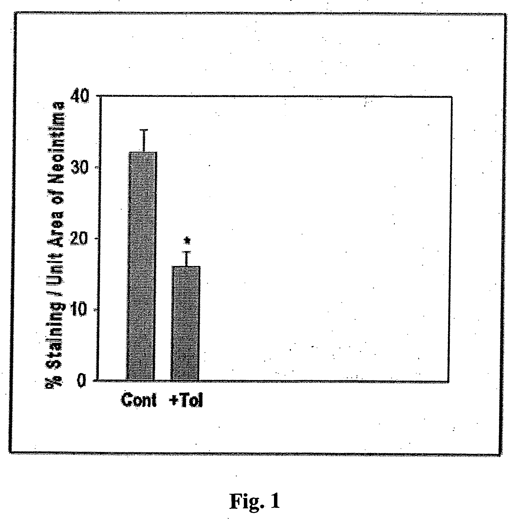 Methods and compositions involving aldose reductase