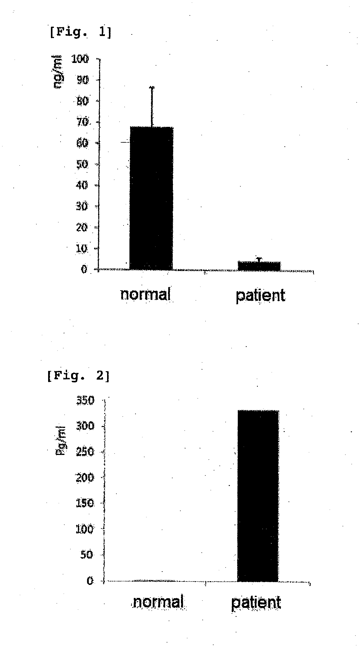 Kit for diagnosing prostate cancer and diagnosis method