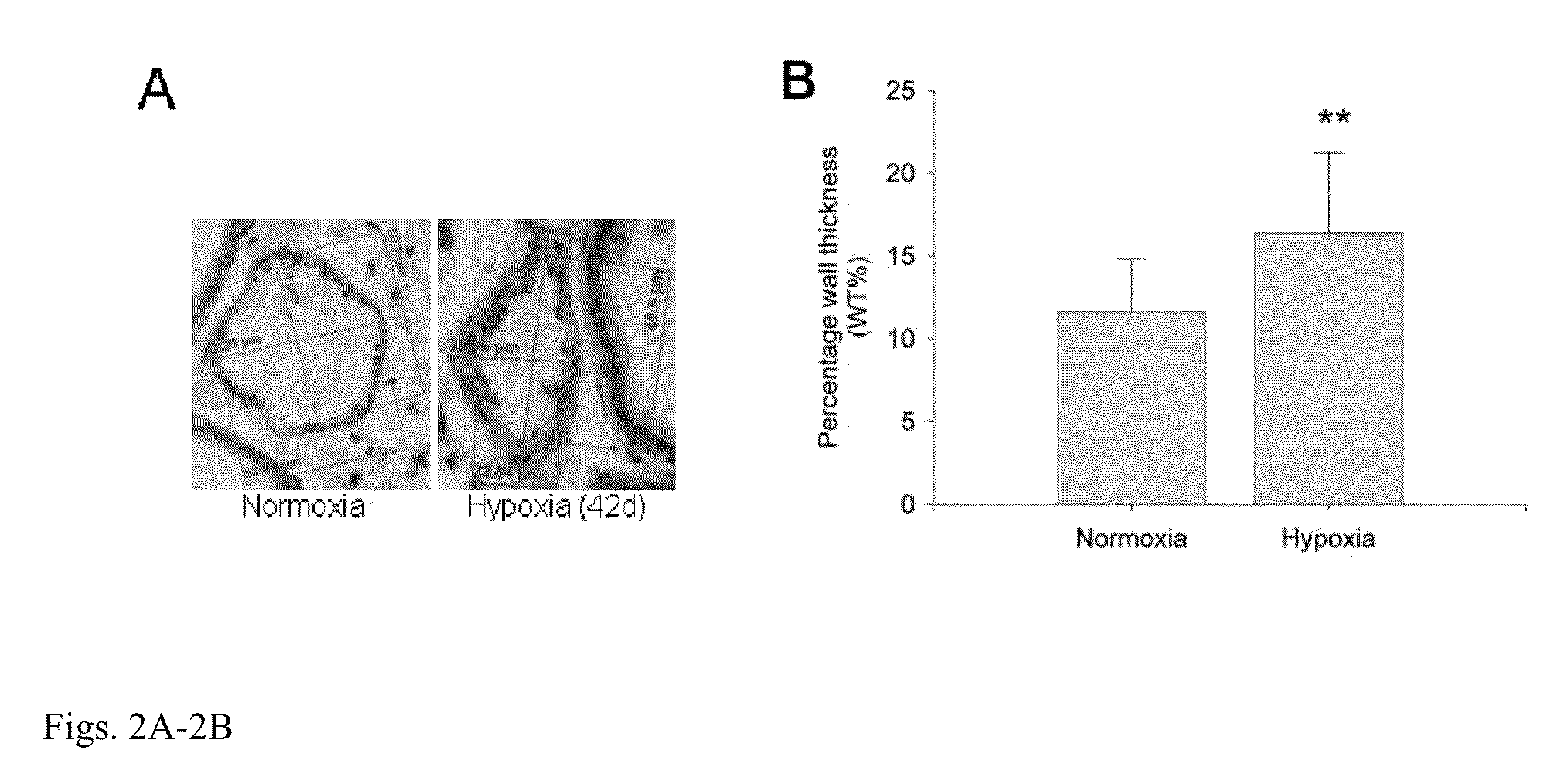 Method for treating a neurological disorder associated with hypoxia using a small moleucule MIF inhibitor