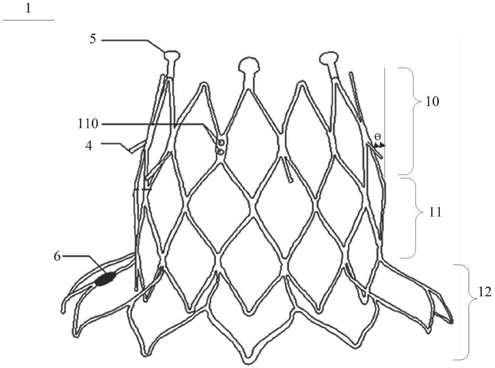 D-shaped invasive prosthetic heart valve