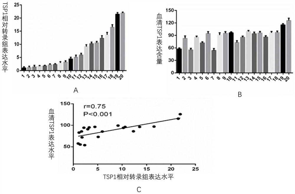 Application of human thrombin-sensitive protein-1 in preparation of kit for predicting chemotherapy effect of intrahepatic cholangiocarcinoma