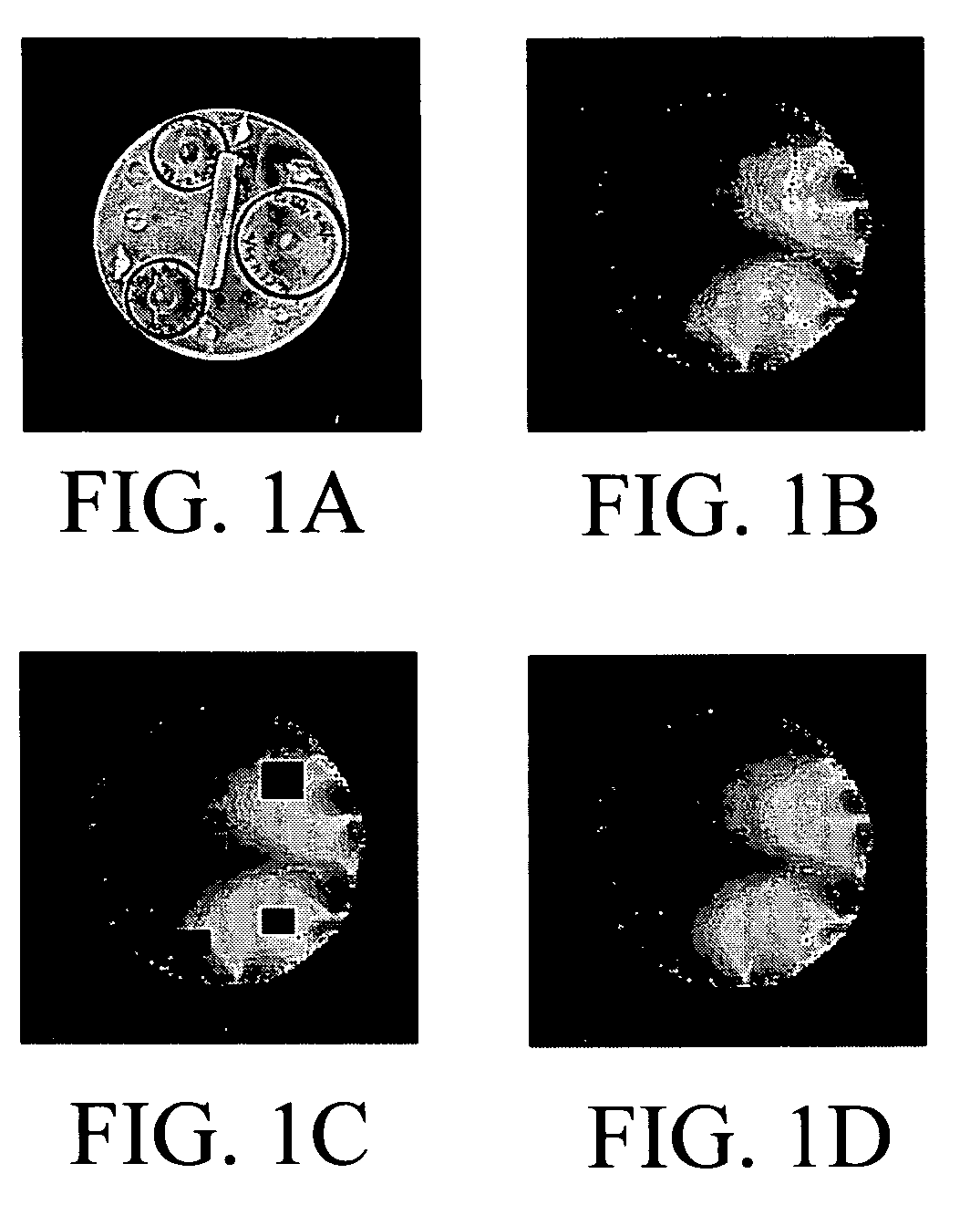 Method for applying an in-painting technique to correct images in parallel imaging