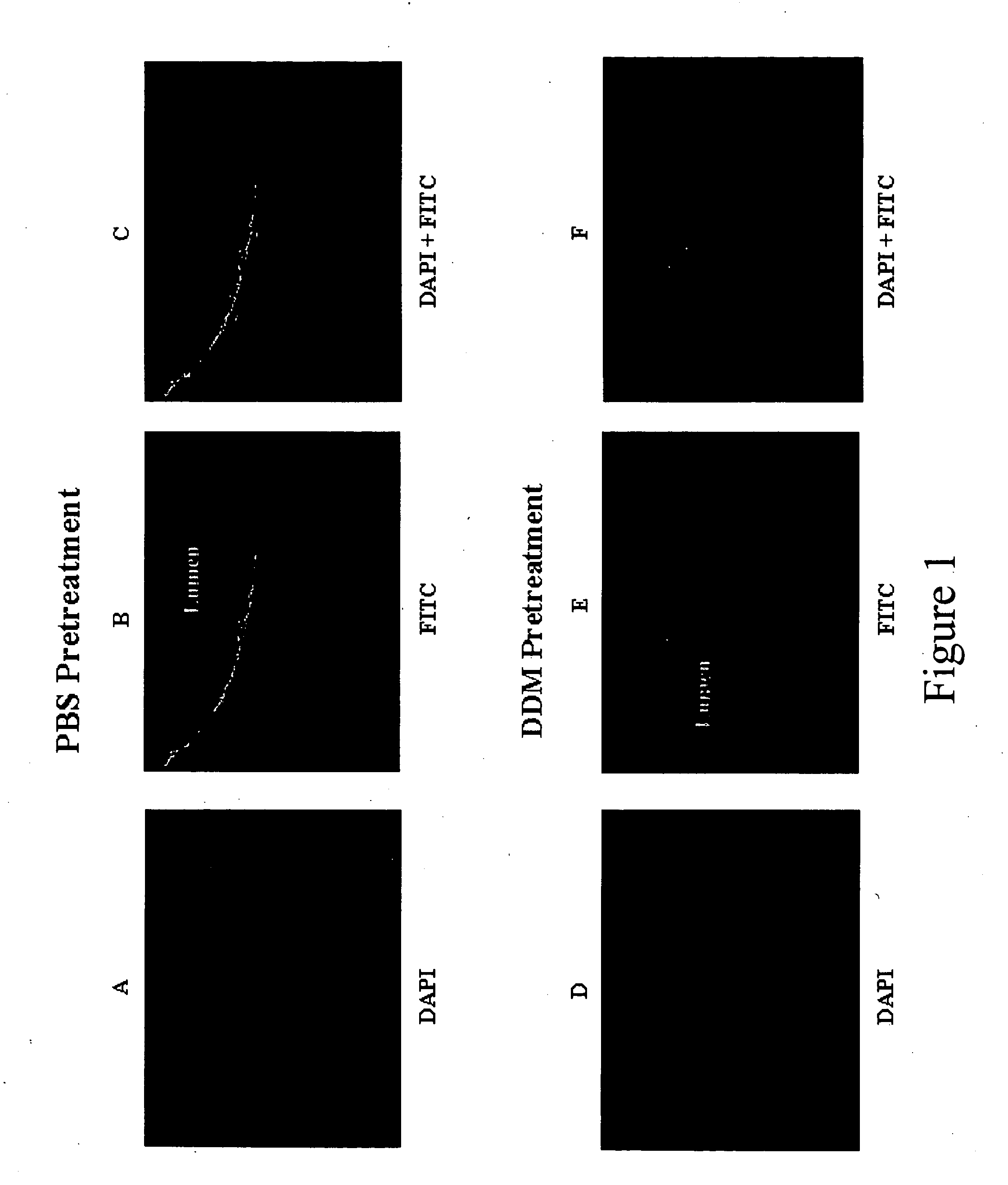 Compositions and methods for the enhanced uptake of therapeutic agents through the bladder epithelium
