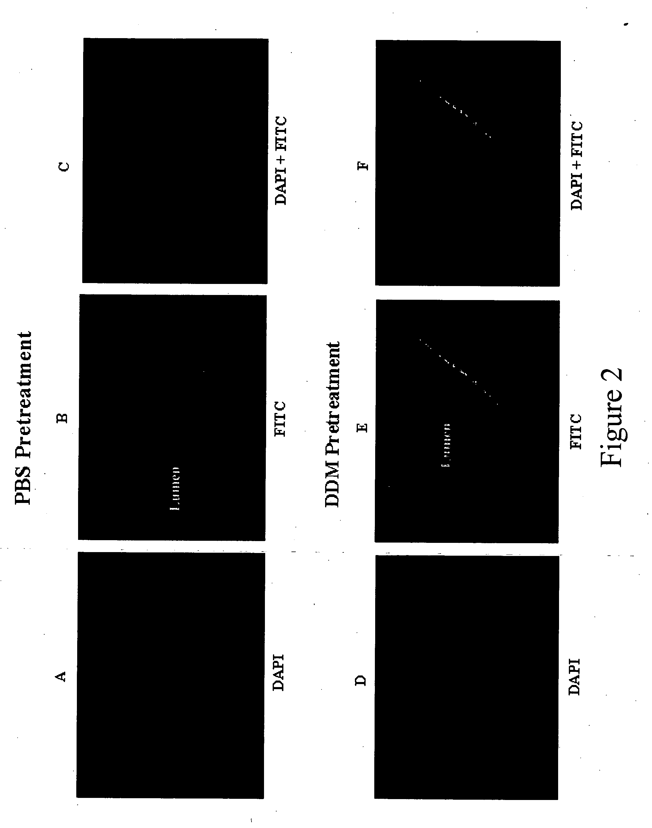 Compositions and methods for the enhanced uptake of therapeutic agents through the bladder epithelium