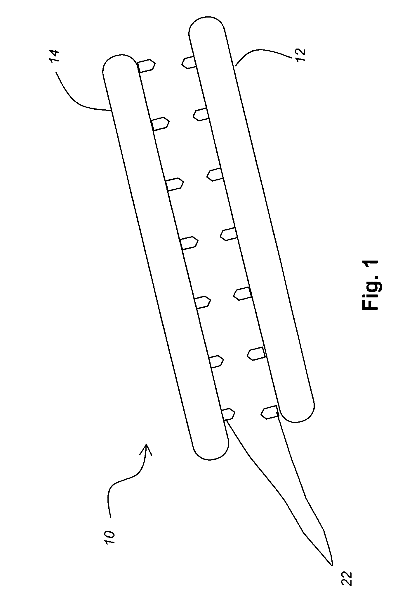 Systems and methods for valve annulus remodeling