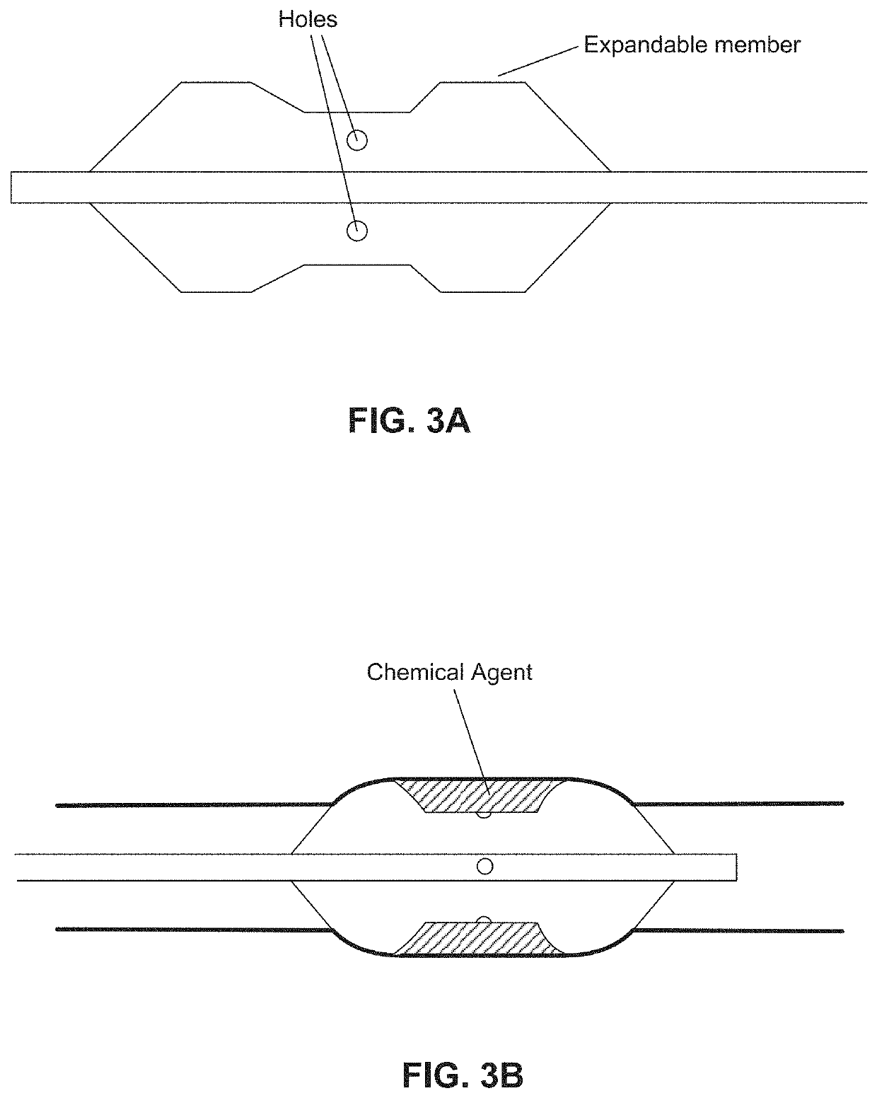 Chemical ablation and method of treatment for various diseases