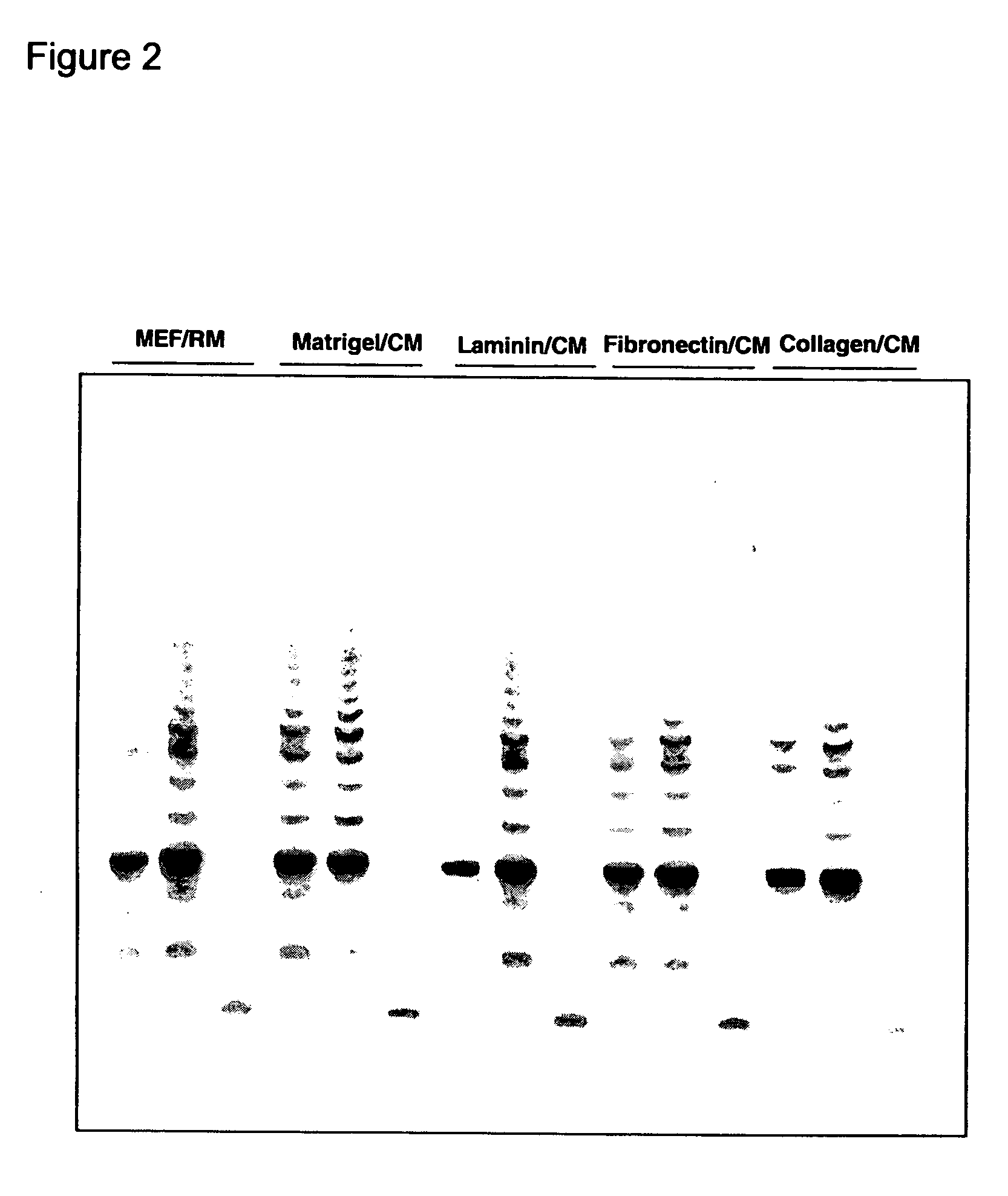 Differentiated cells suitable for human therapy