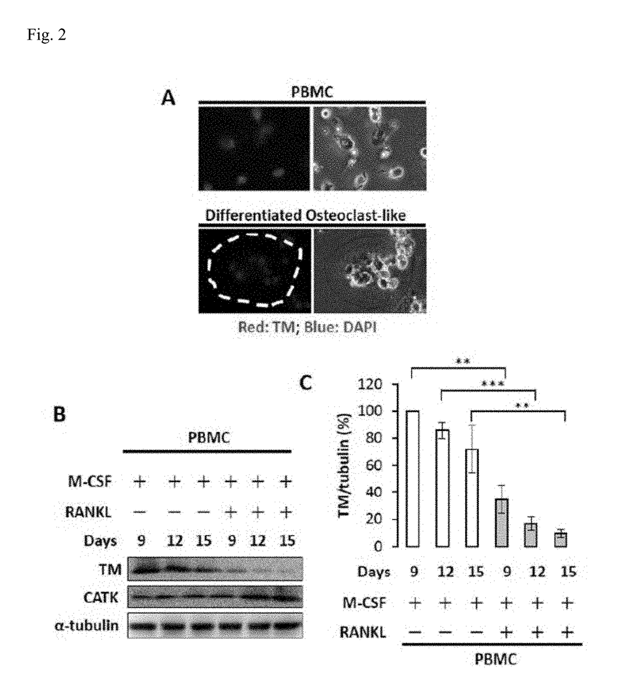 Tmd1 protein for treating bone loss diseases