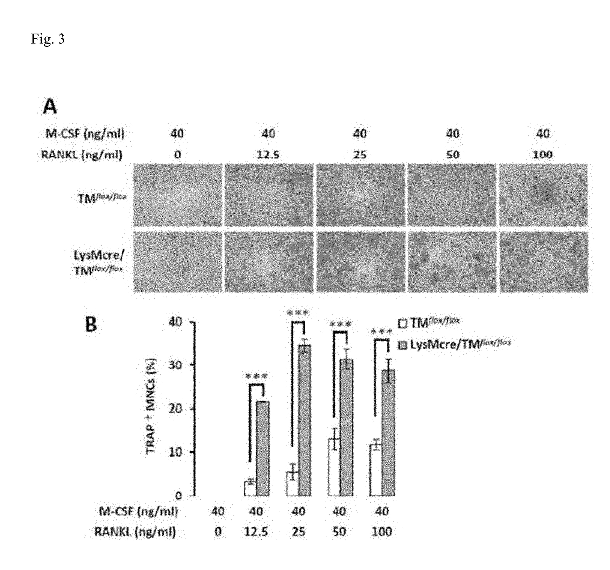 Tmd1 protein for treating bone loss diseases