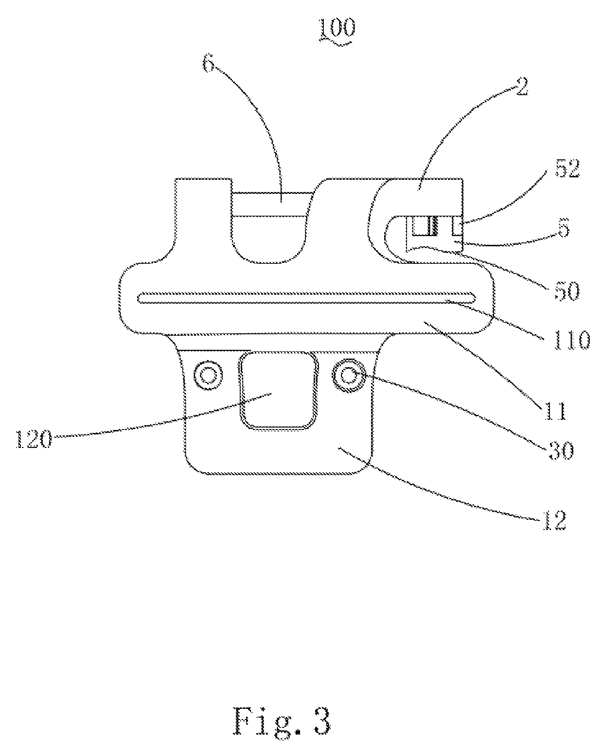 Customized surgical cutting guide for total knee replacement and method for making thereof