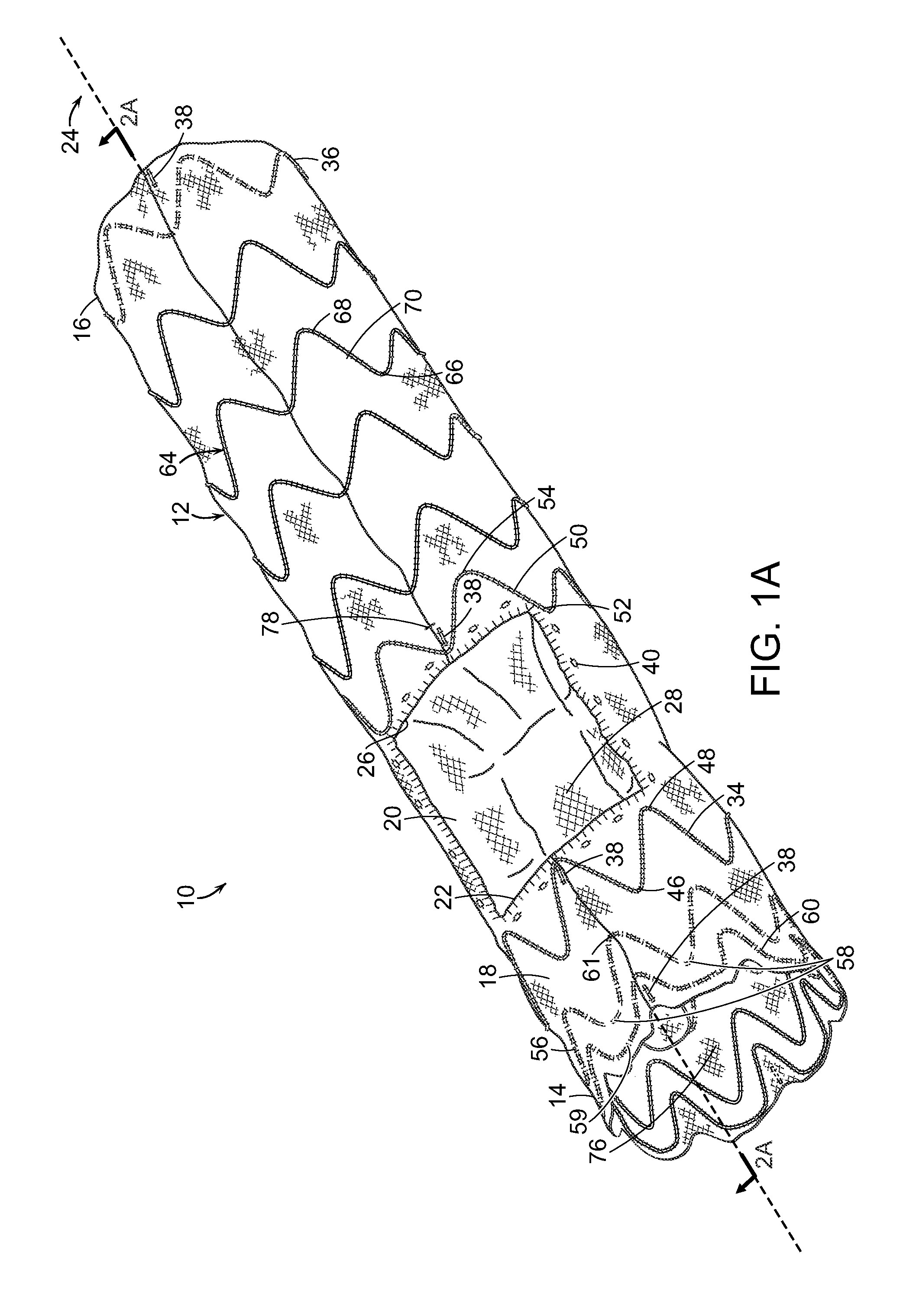 Device and method for aortic branched vessel repair