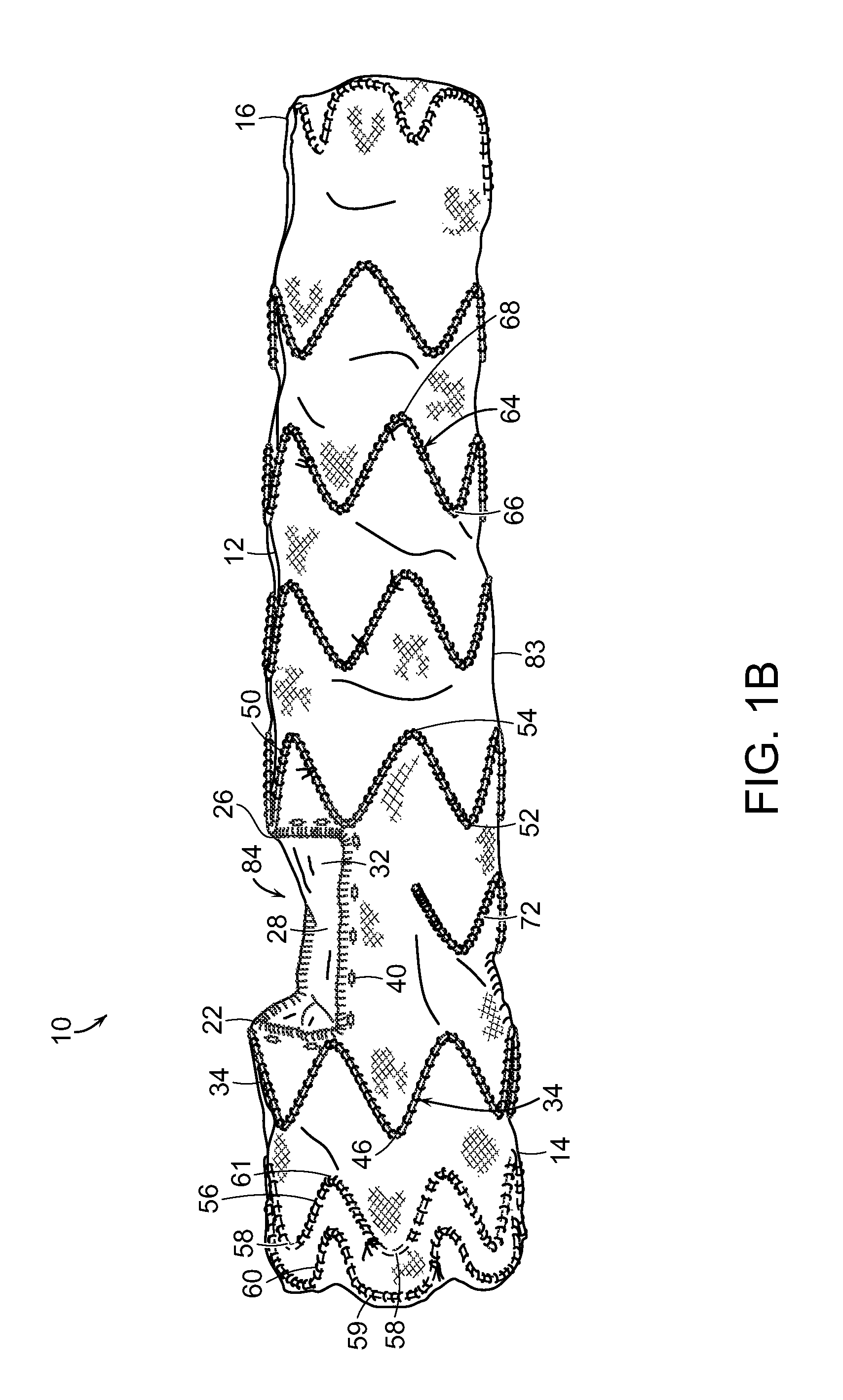 Device and method for aortic branched vessel repair
