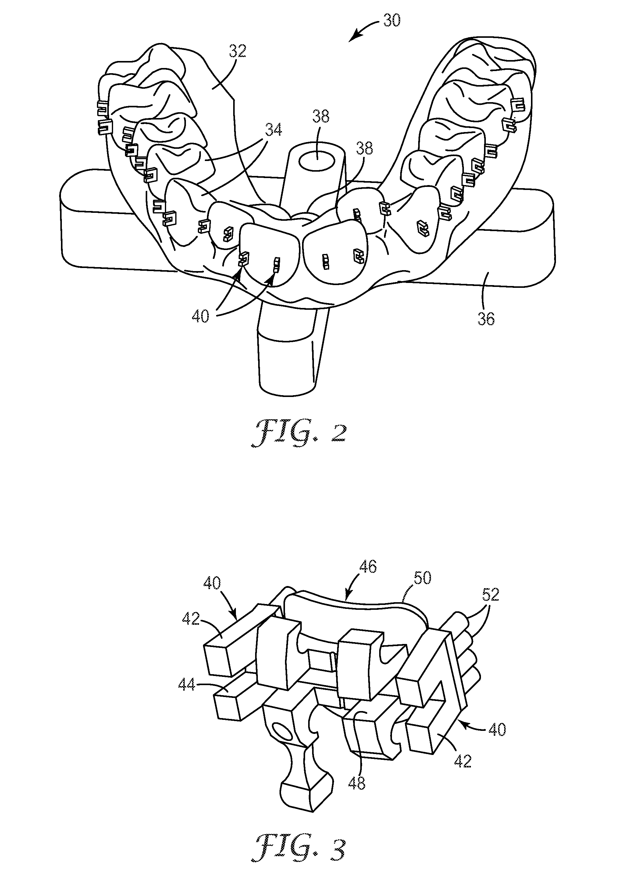 Methods and assemblies for making an orthodontic bonding tray using rapid prototyping