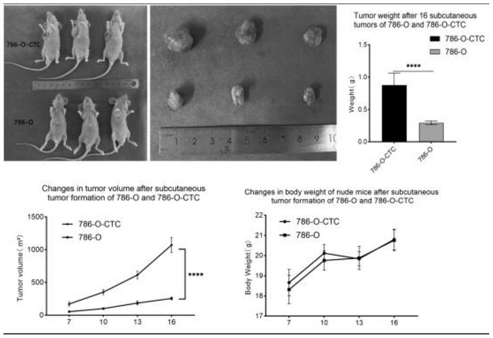 Kidney cancer circulating tumor cell line and acquisition, separation and culture method