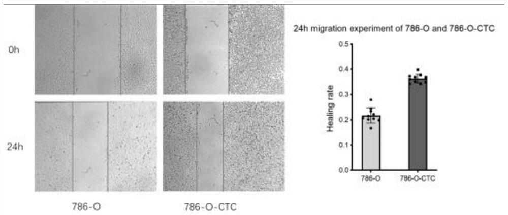 Kidney cancer circulating tumor cell line and acquisition, separation and culture method