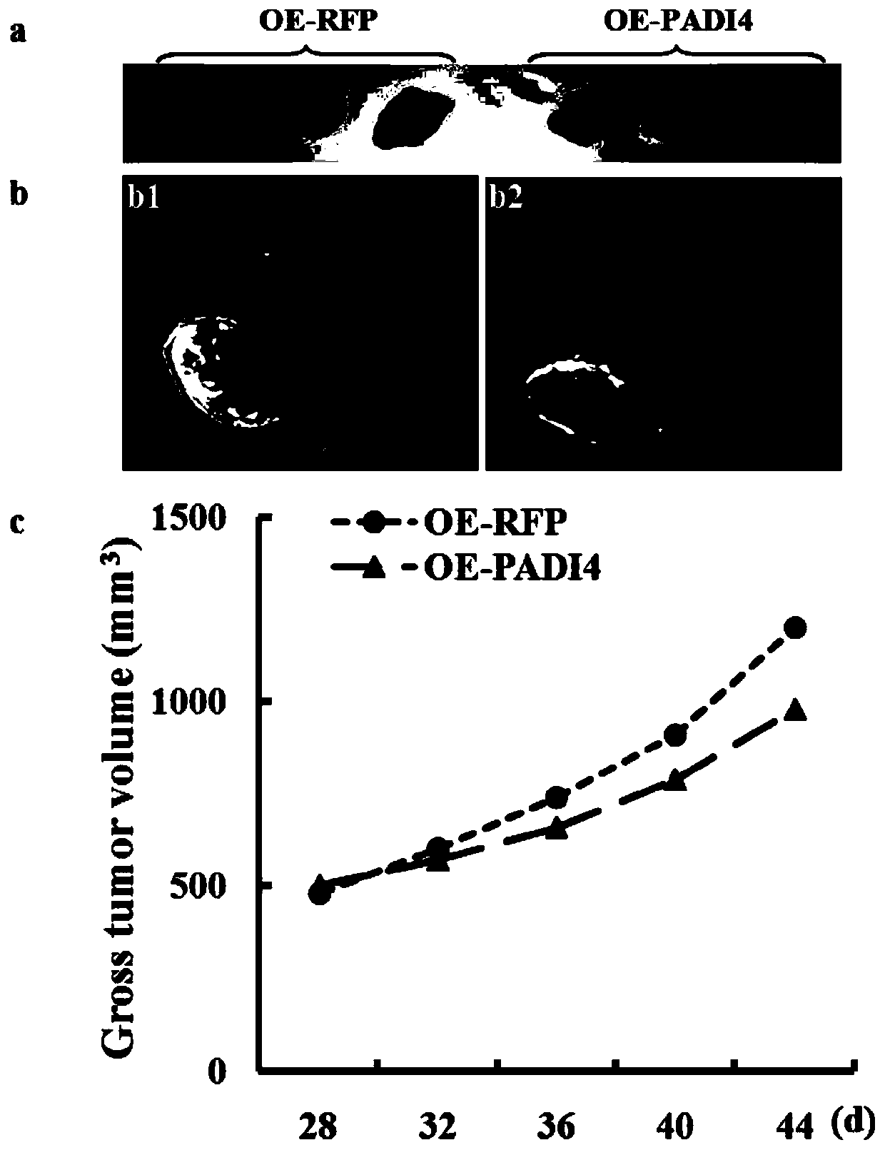 Padi4-stimulated DC-CIK cell composition and application