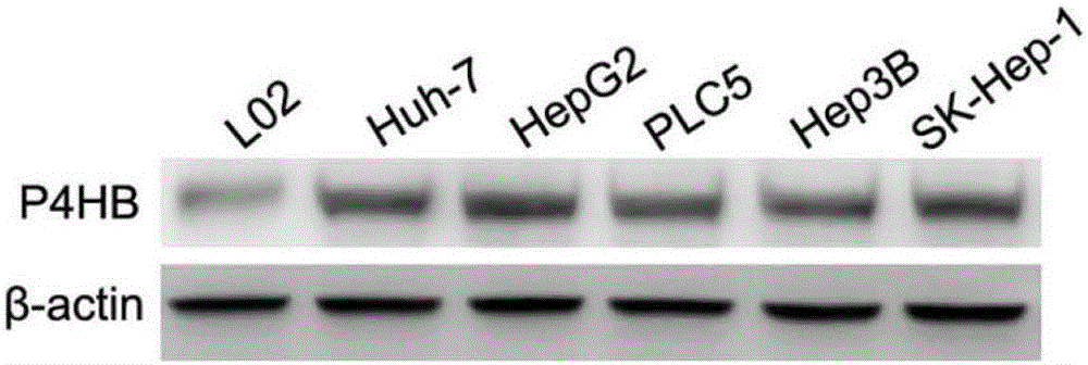 Inhibitor for P4HB gene expression and application of inhibitor