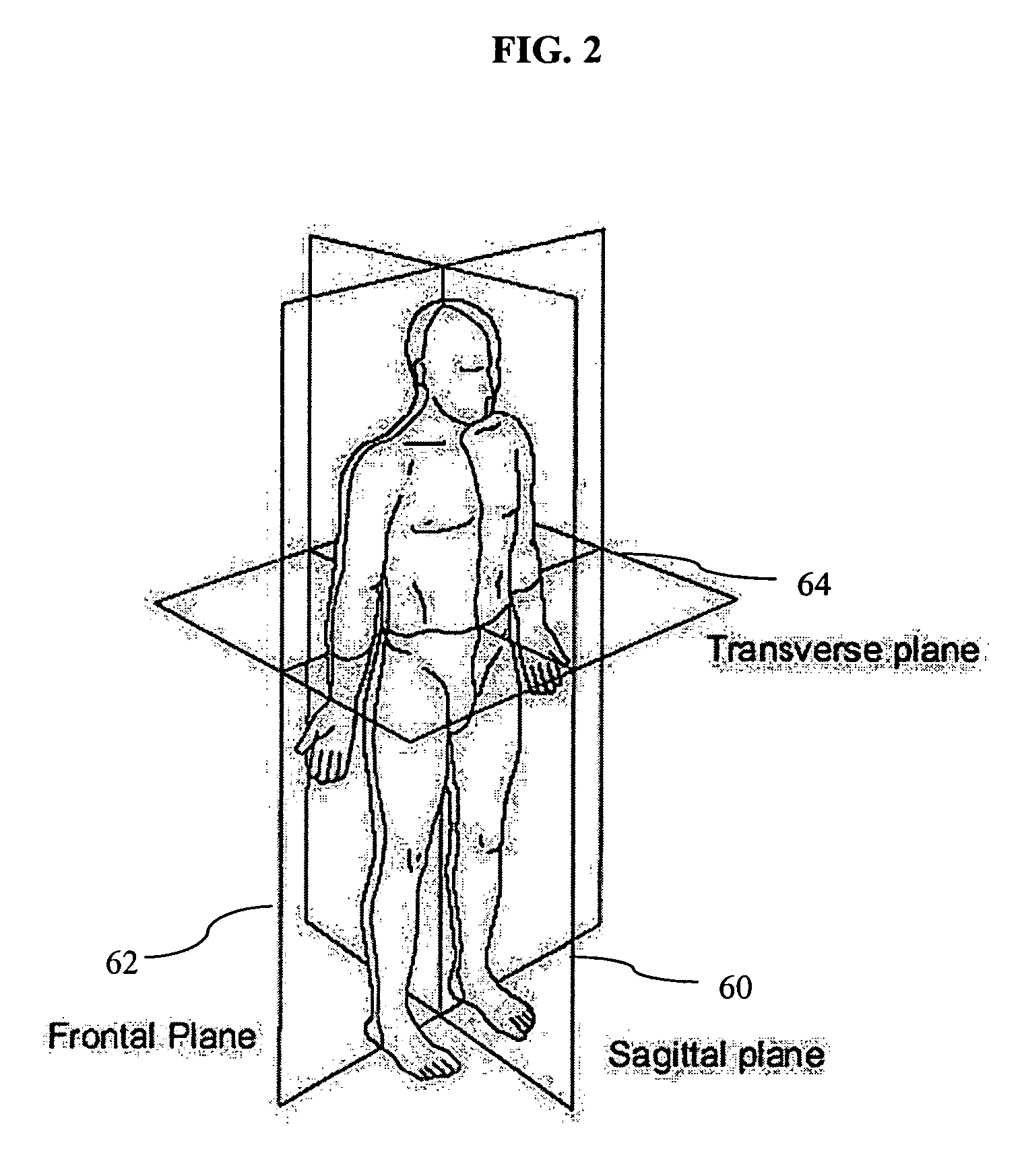 Exoskeletal device for rehabilitation