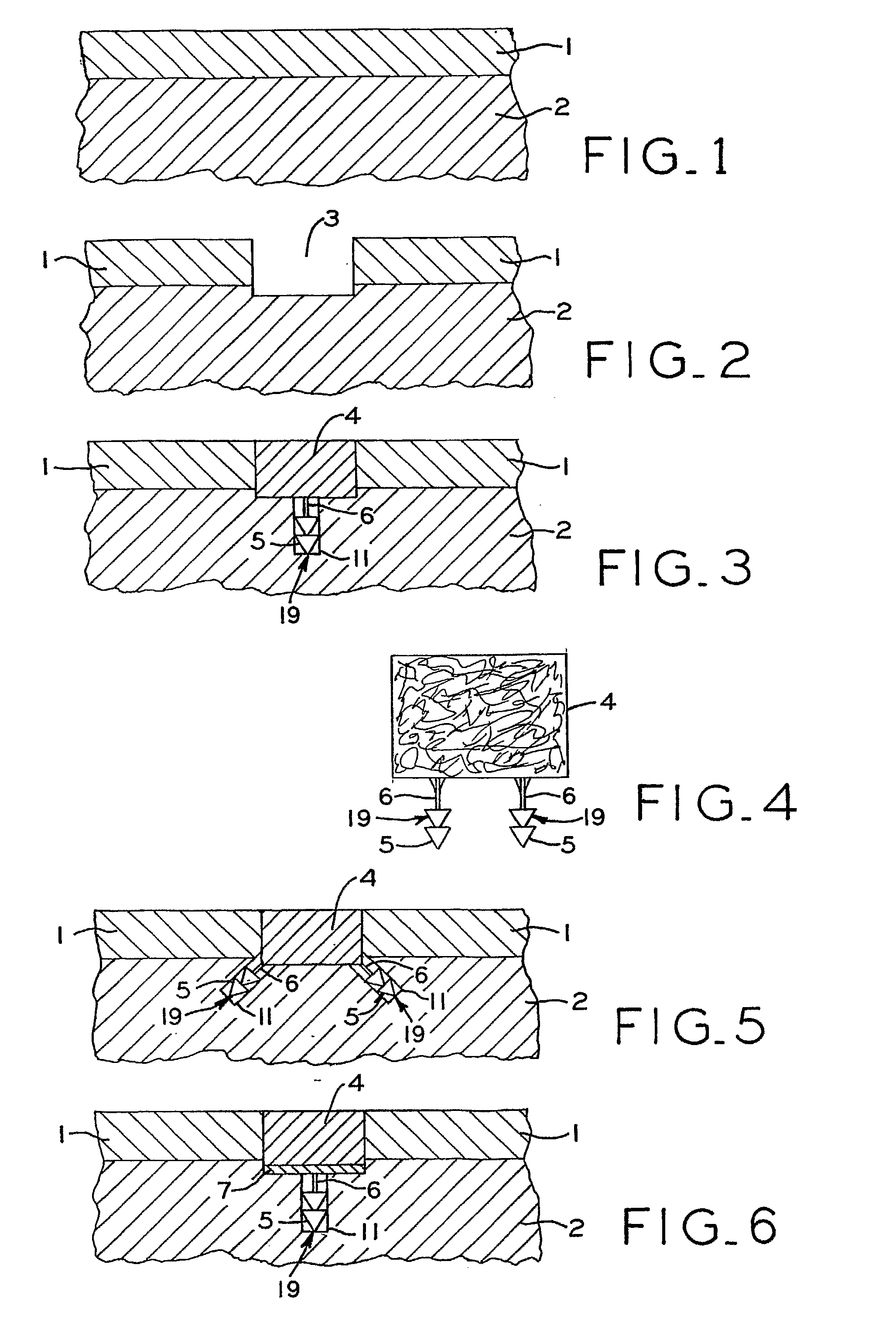 Articular Cartilage Fixation Device and Method