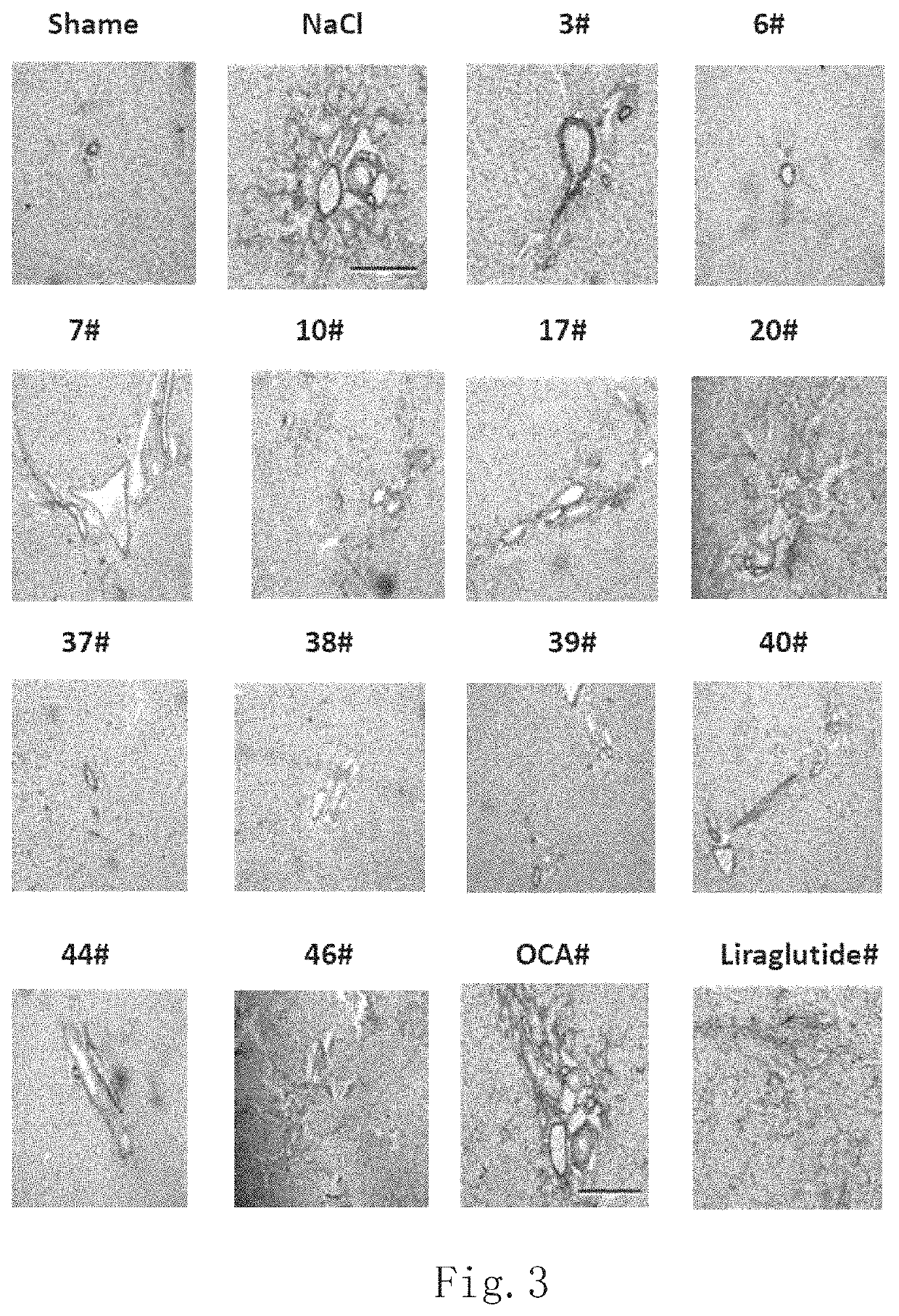 Treatment of biliary cirrhosis based on oxyntomodulin analogue GLP-1R/GCGR dual-target agonist peptide