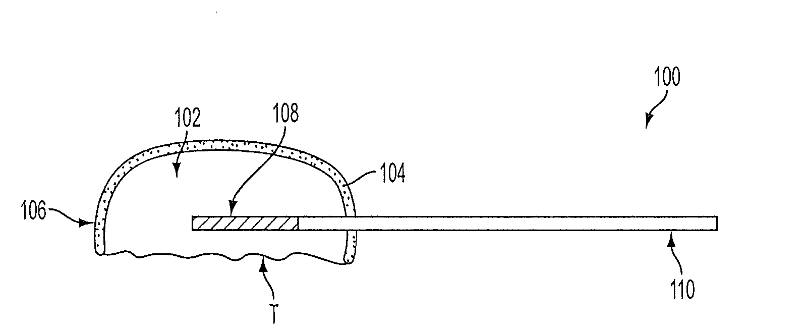 Devices and methods for conforming photodynamic therapy to specific anatomic locations