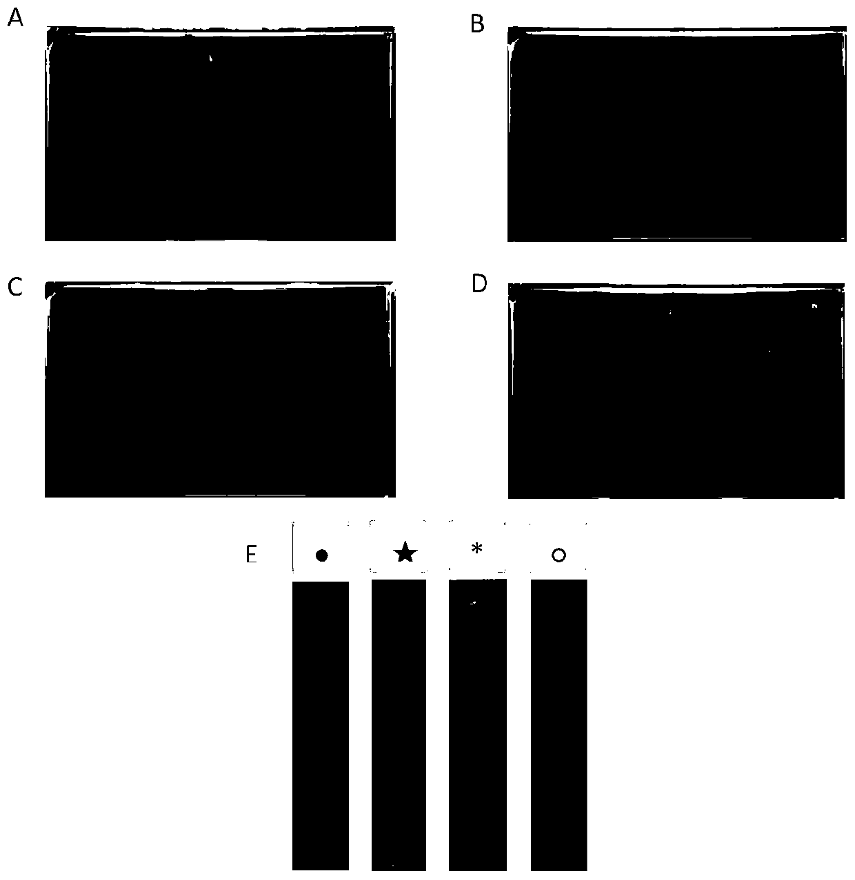 Detection plate for high-flux screening of zoonotic pathogenic bacterium phage and application of detection plate