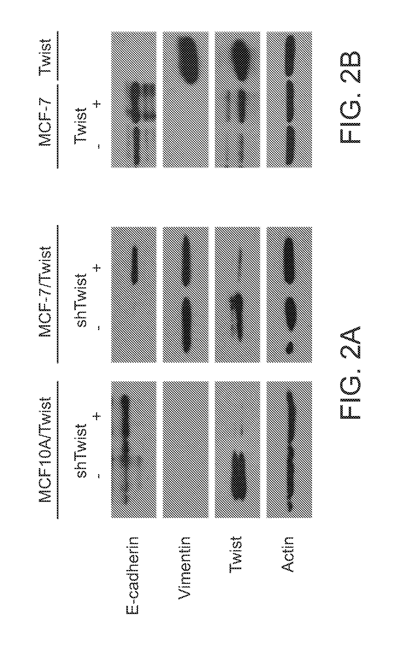 Compositions and Methods for Characterizing Breast Cancer