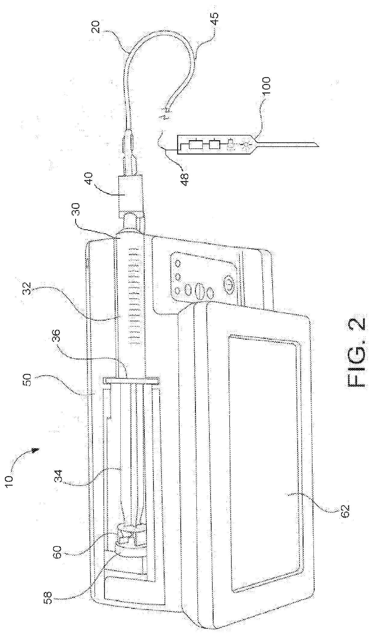 Method and apparatus for performing a peripheral nerve block
