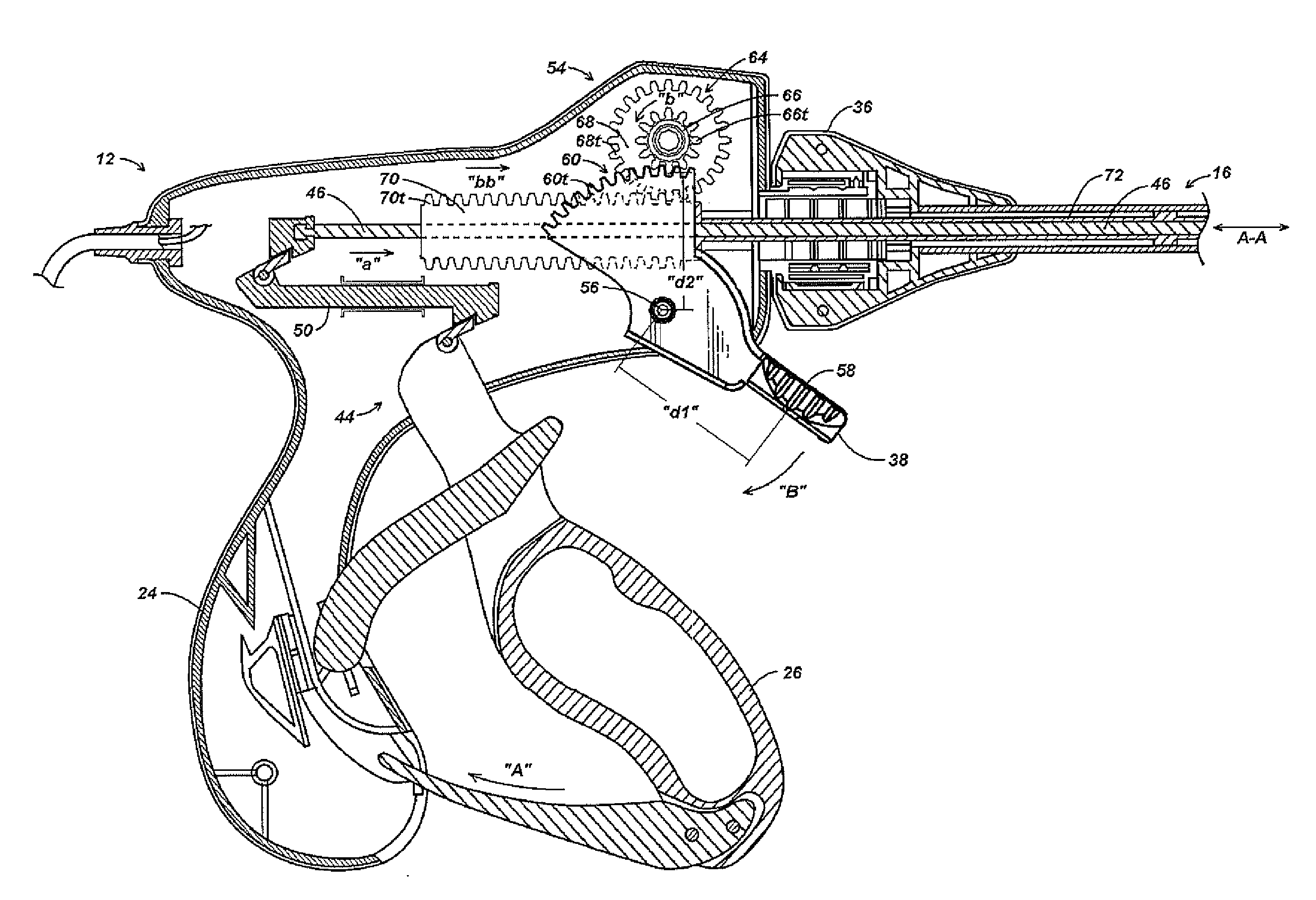 Pinion Blade Drive Mechanism for a Laparoscopic Vessel Dissector