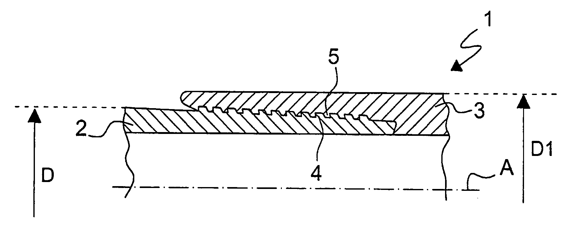 Threaded joint with high radial loads and differentially treated surfaces