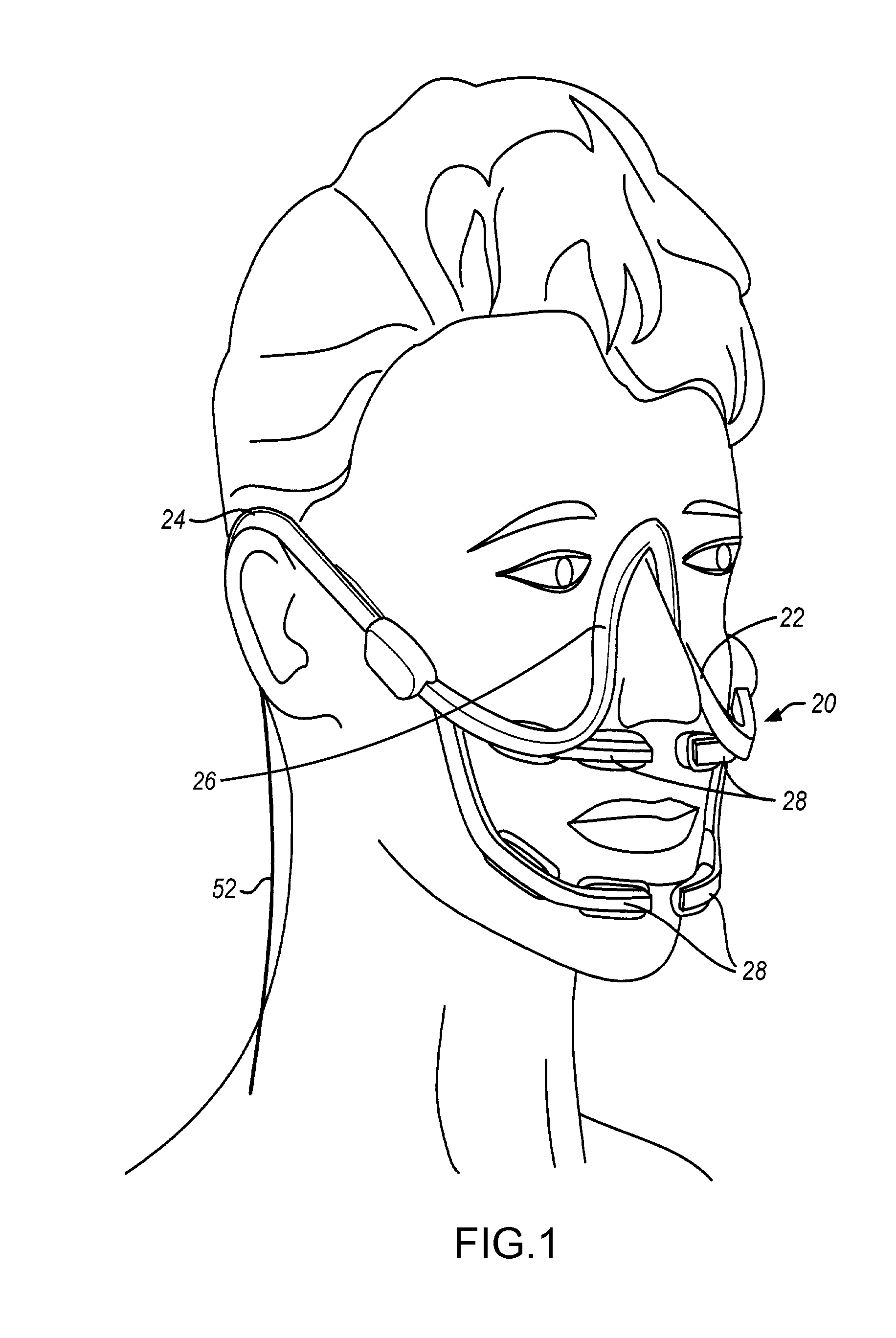 Methods and apparatuses useful for regulating bone remodeling or tooth movement using light therapy, a functional appliance, and/or vitamin d
