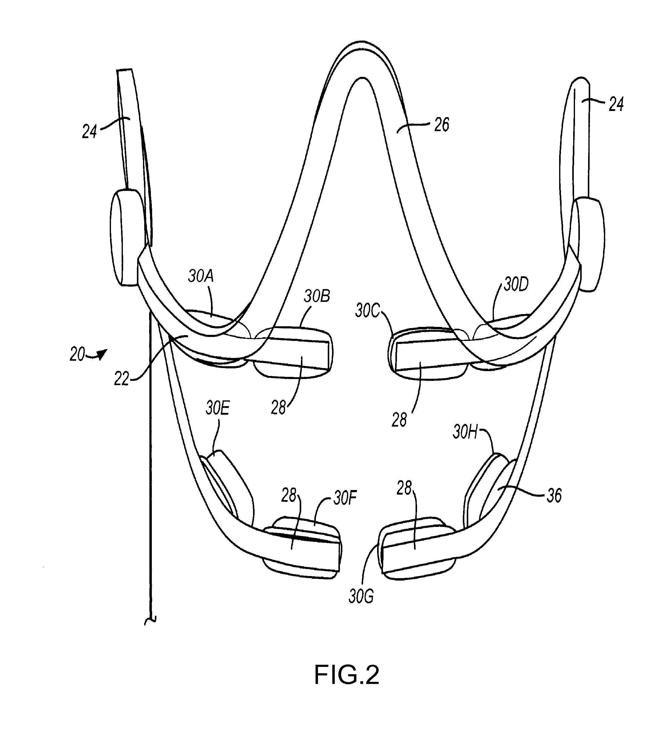 Methods and apparatuses useful for regulating bone remodeling or tooth movement using light therapy, a functional appliance, and/or vitamin d