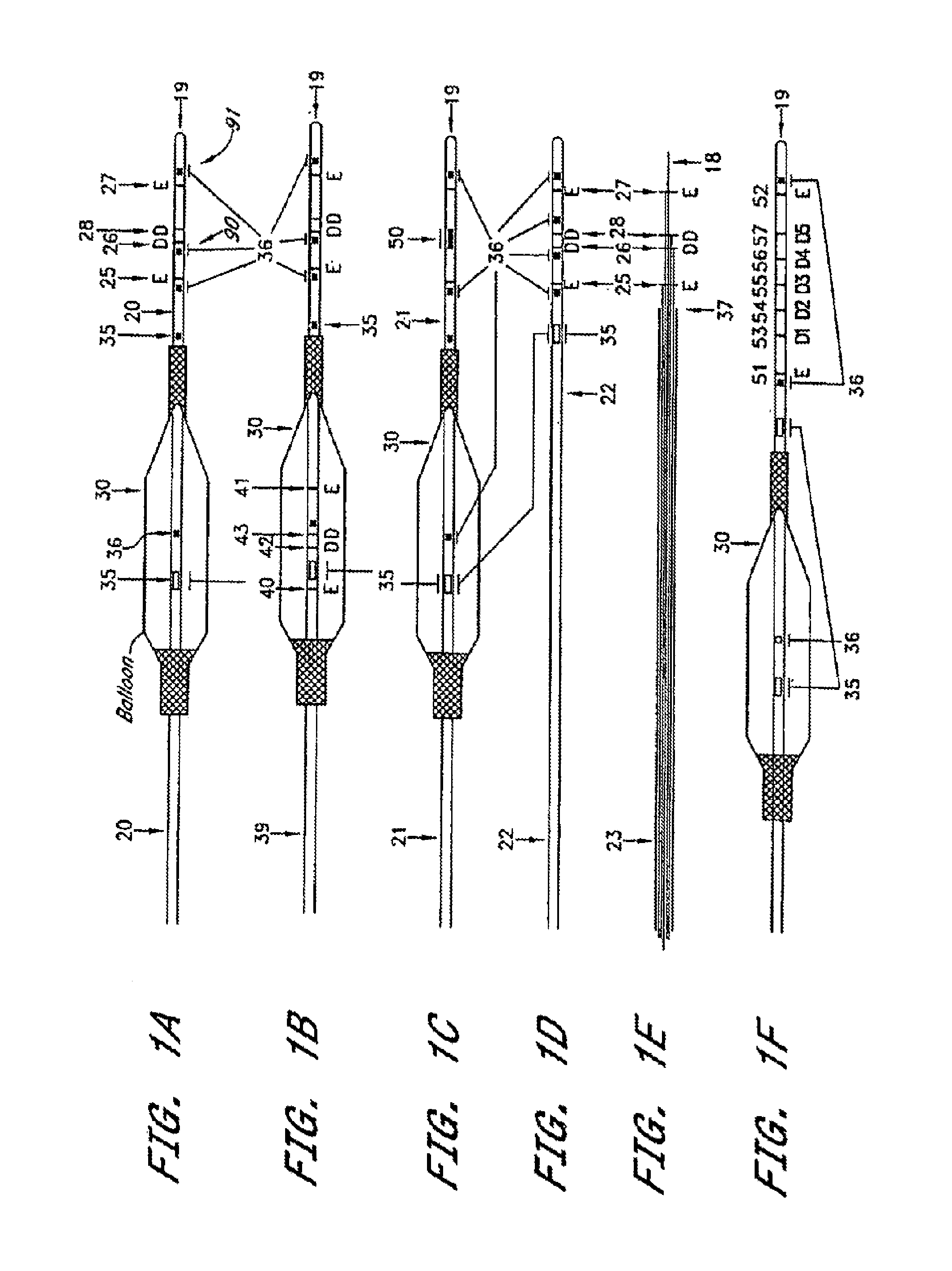 Systems and methods for determining phasic cardiac cycle measurements