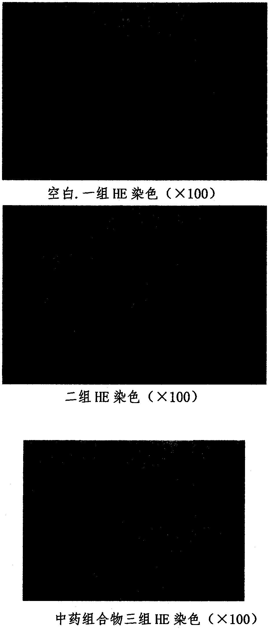Thermal burn Chinese medicine composition and preparation method thereof