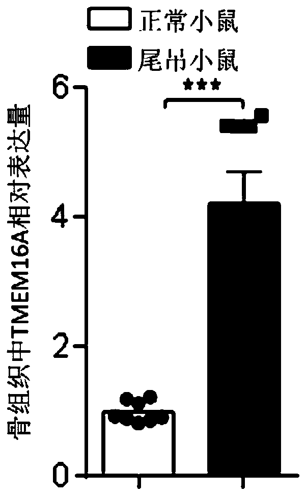 TMEM16A taken as osteoporosis marker as well as application, osteoporosis diagnostic kit and medicine thereof