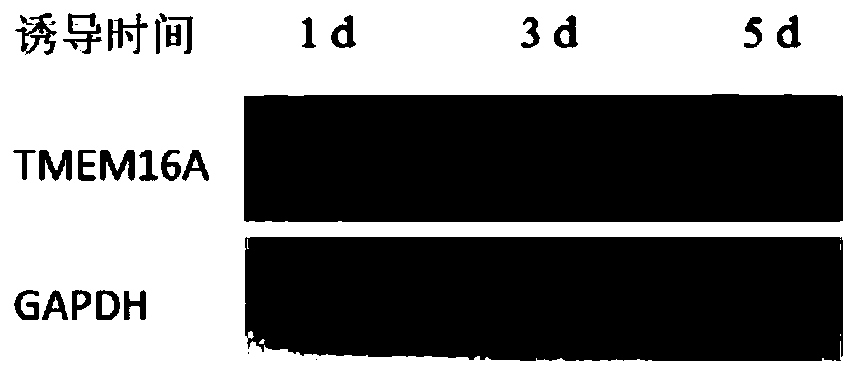 TMEM16A taken as osteoporosis marker as well as application, osteoporosis diagnostic kit and medicine thereof