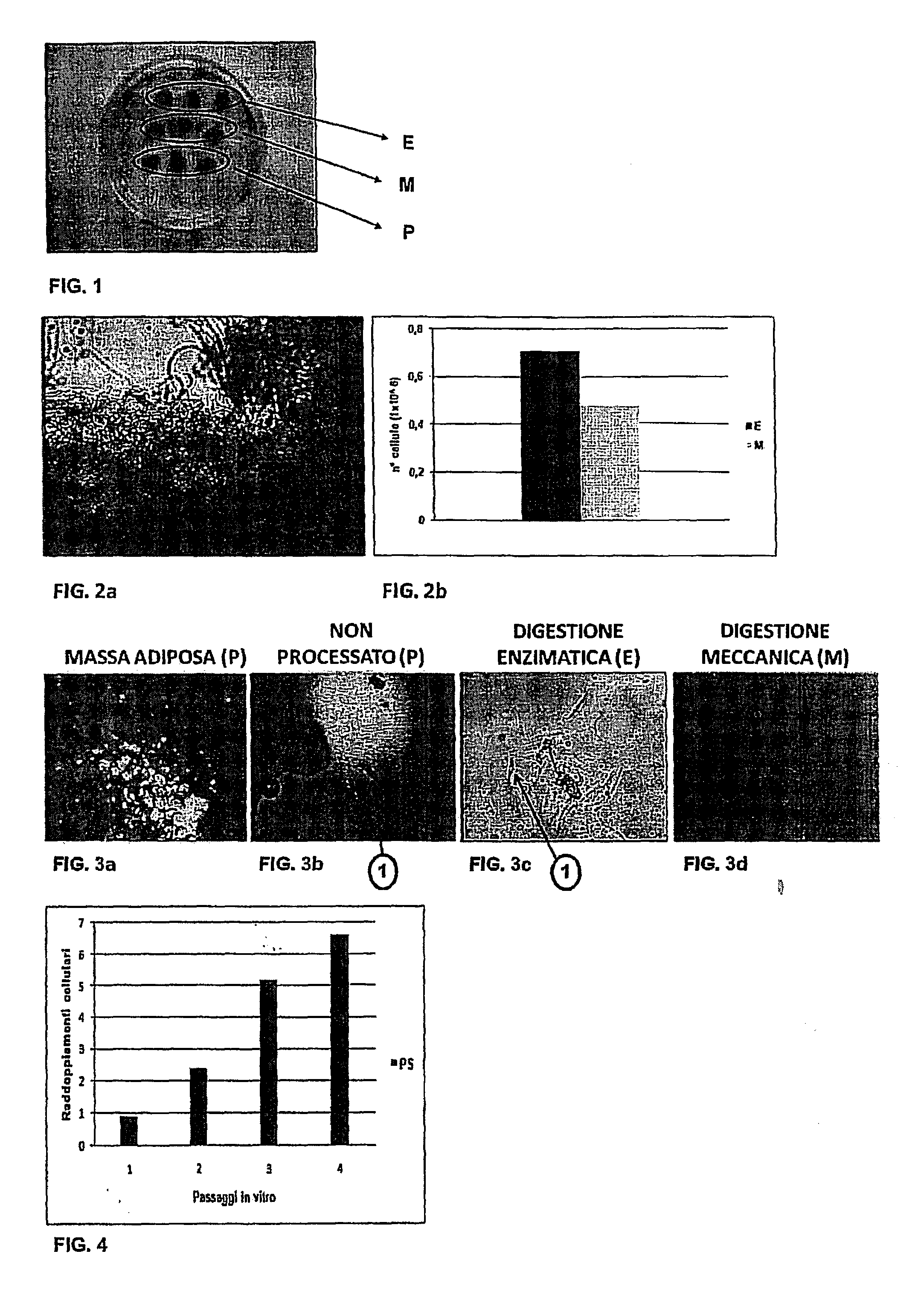 Method for obtaining a population of stromal progenitor cells