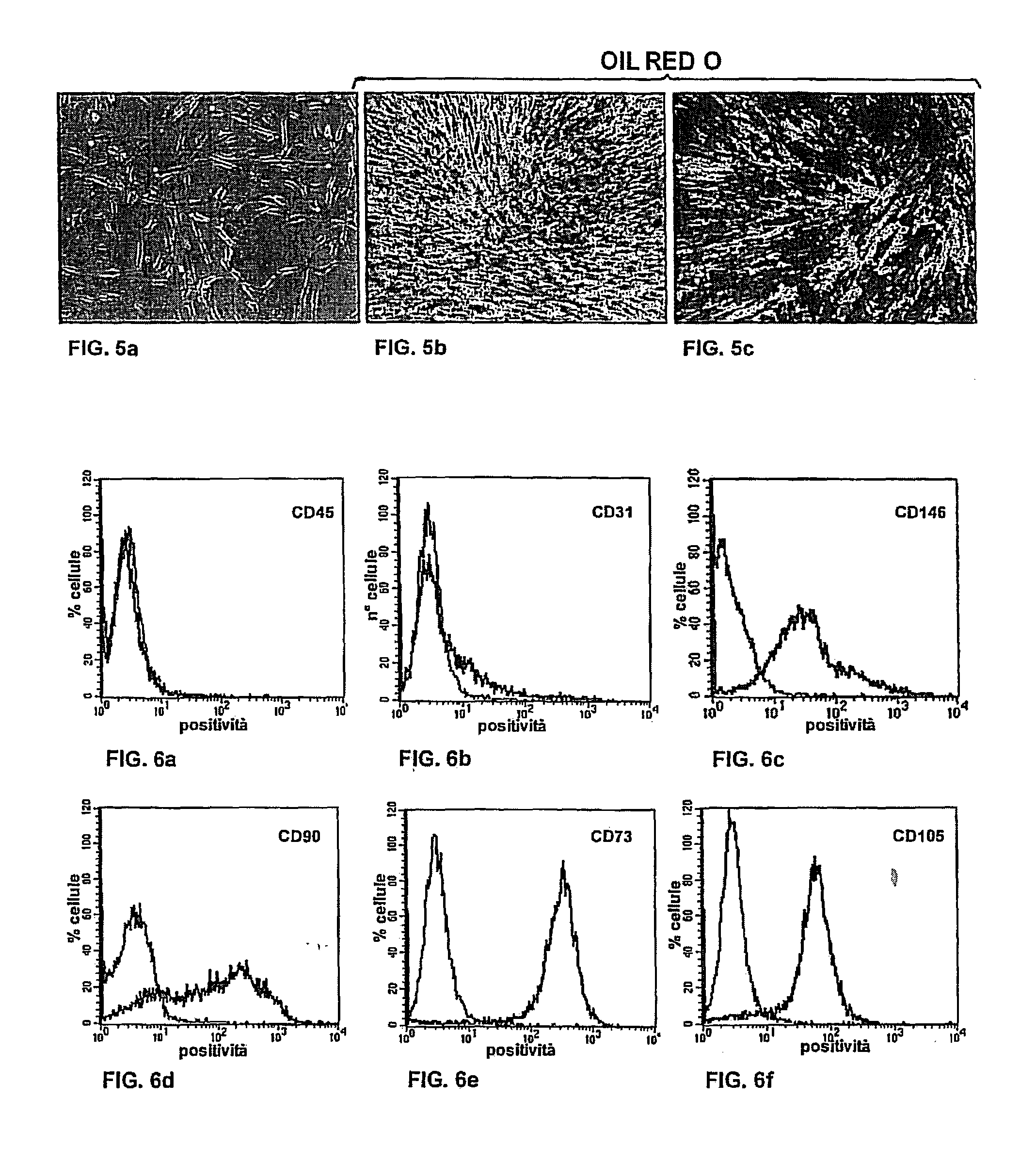 Method for obtaining a population of stromal progenitor cells