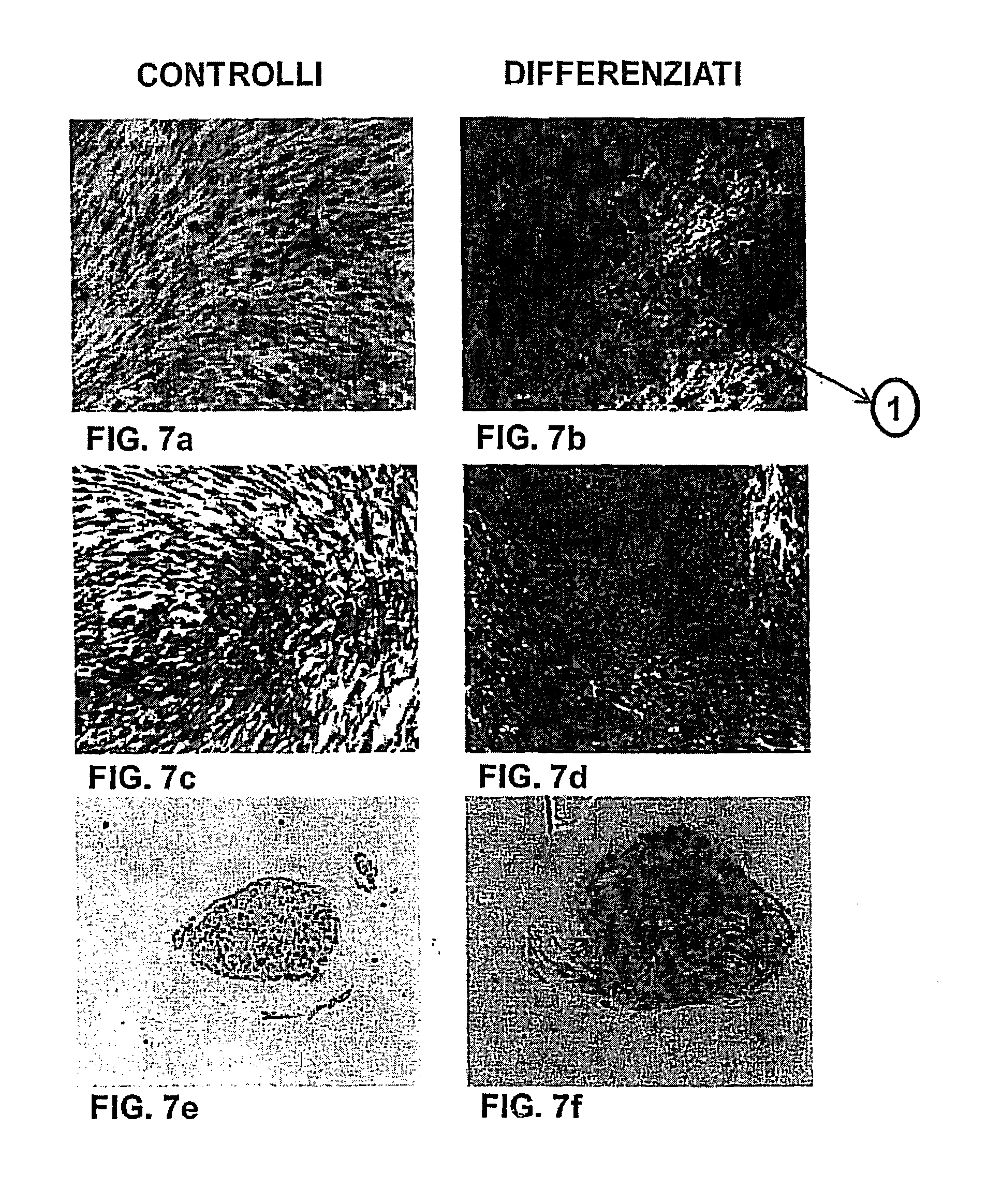 Method for obtaining a population of stromal progenitor cells