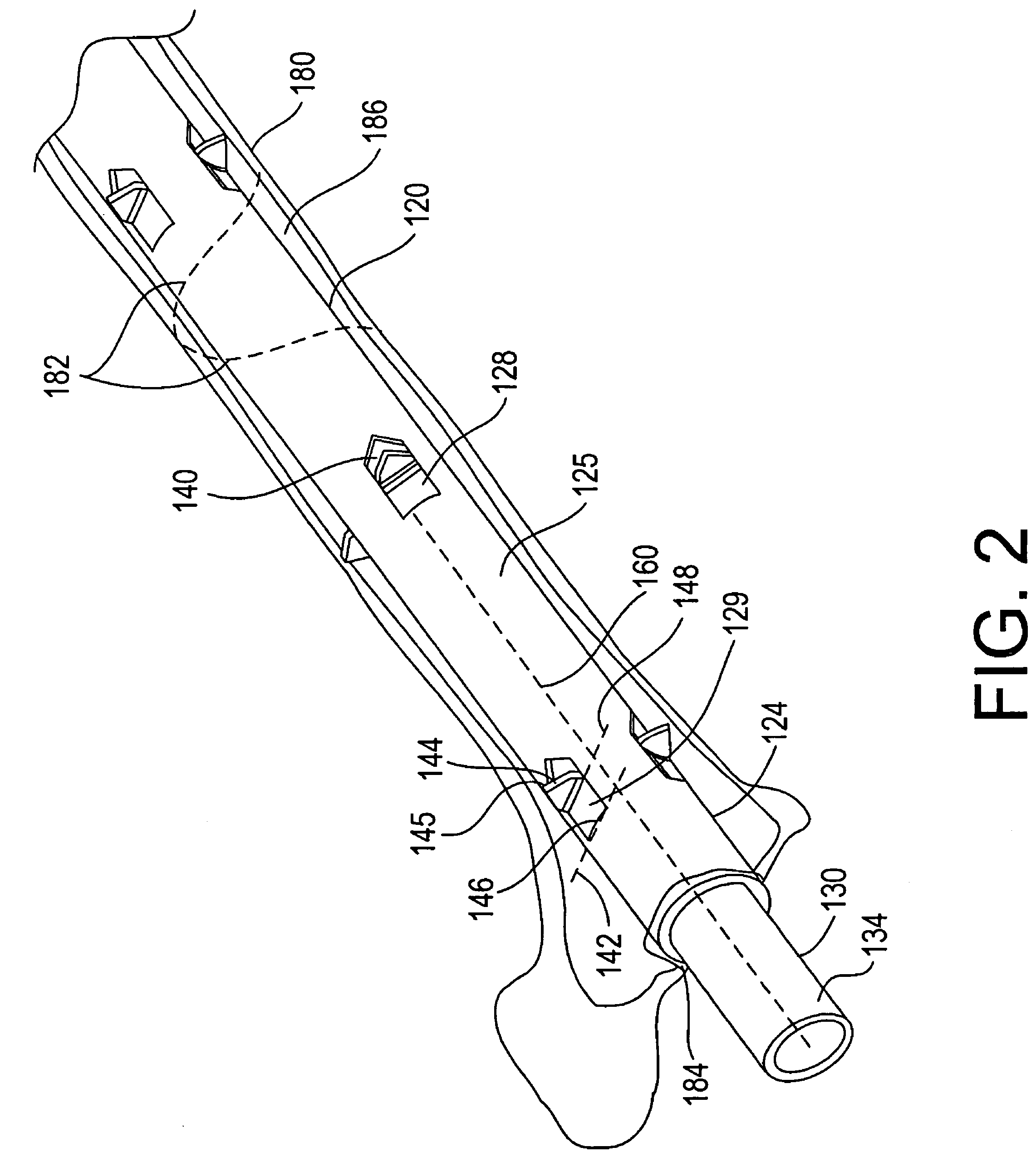 Bone fracture treatment devices and methods of their use