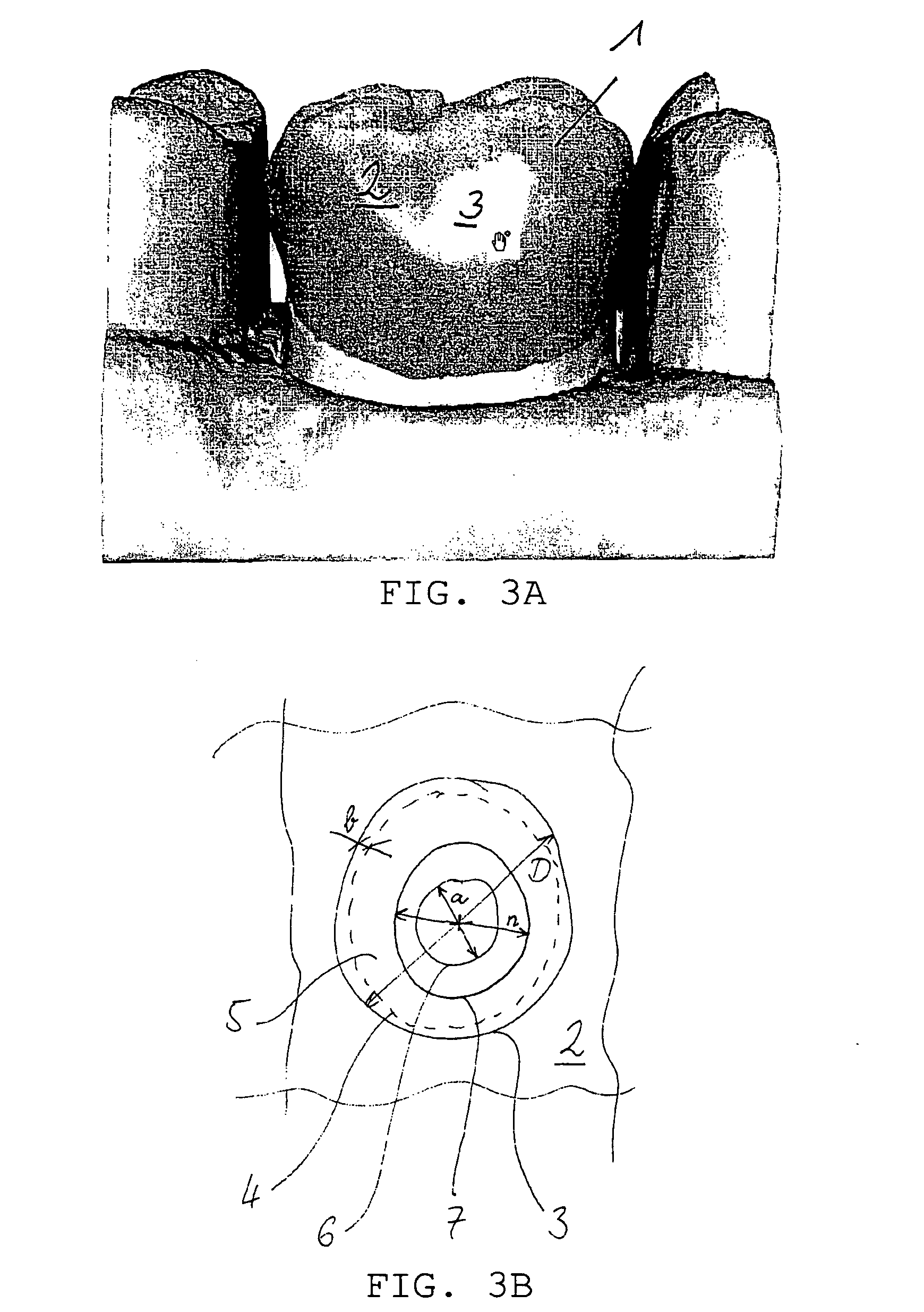 Method of processing a digitized workpiece, particularly a three-dimensional model of a dental prosthetic item to be produced therefrom, and apparatus therefor