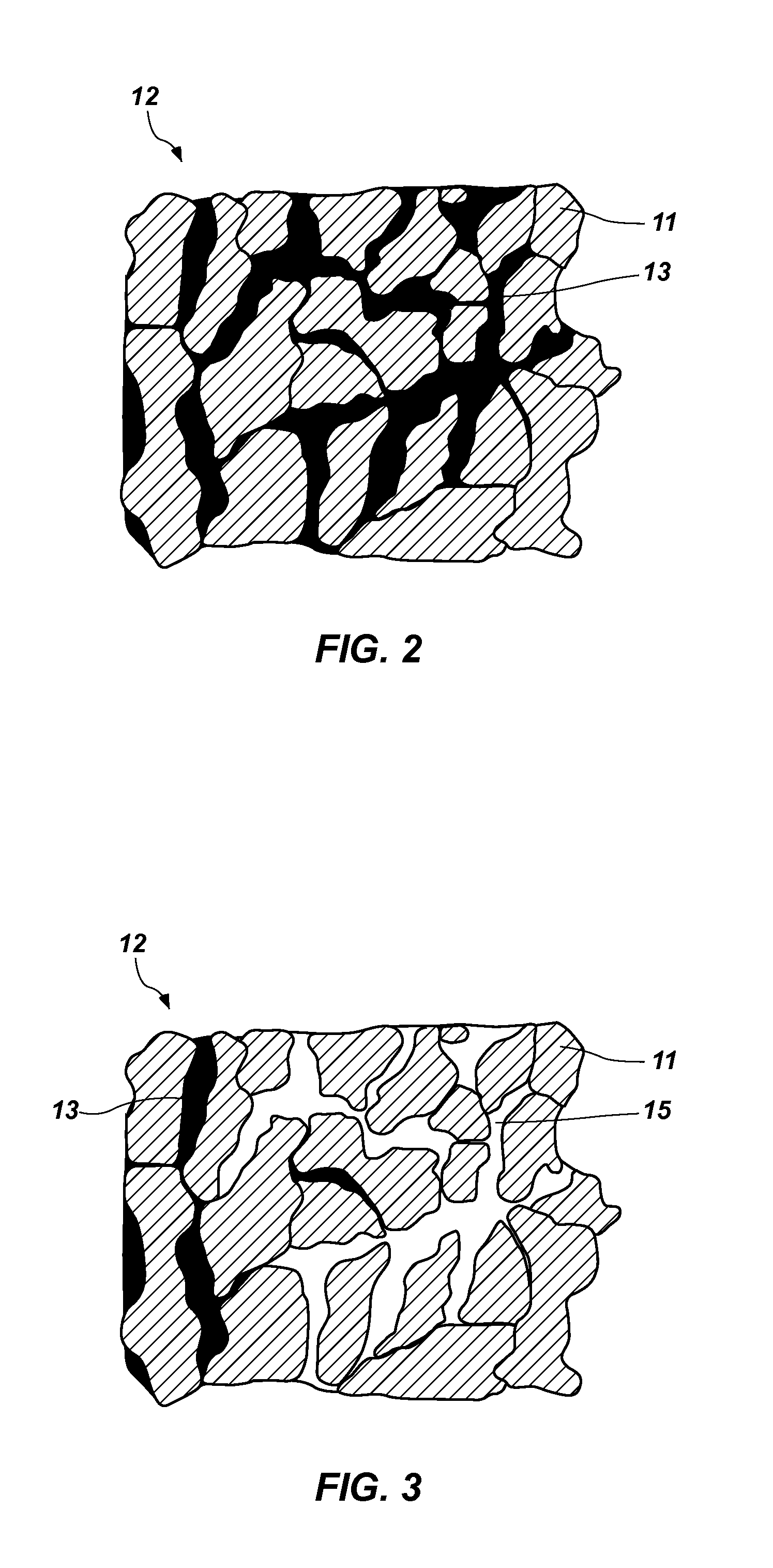 Methods of forming cutting elements by removing metal from interstitial spaces in polycrystalline diamond