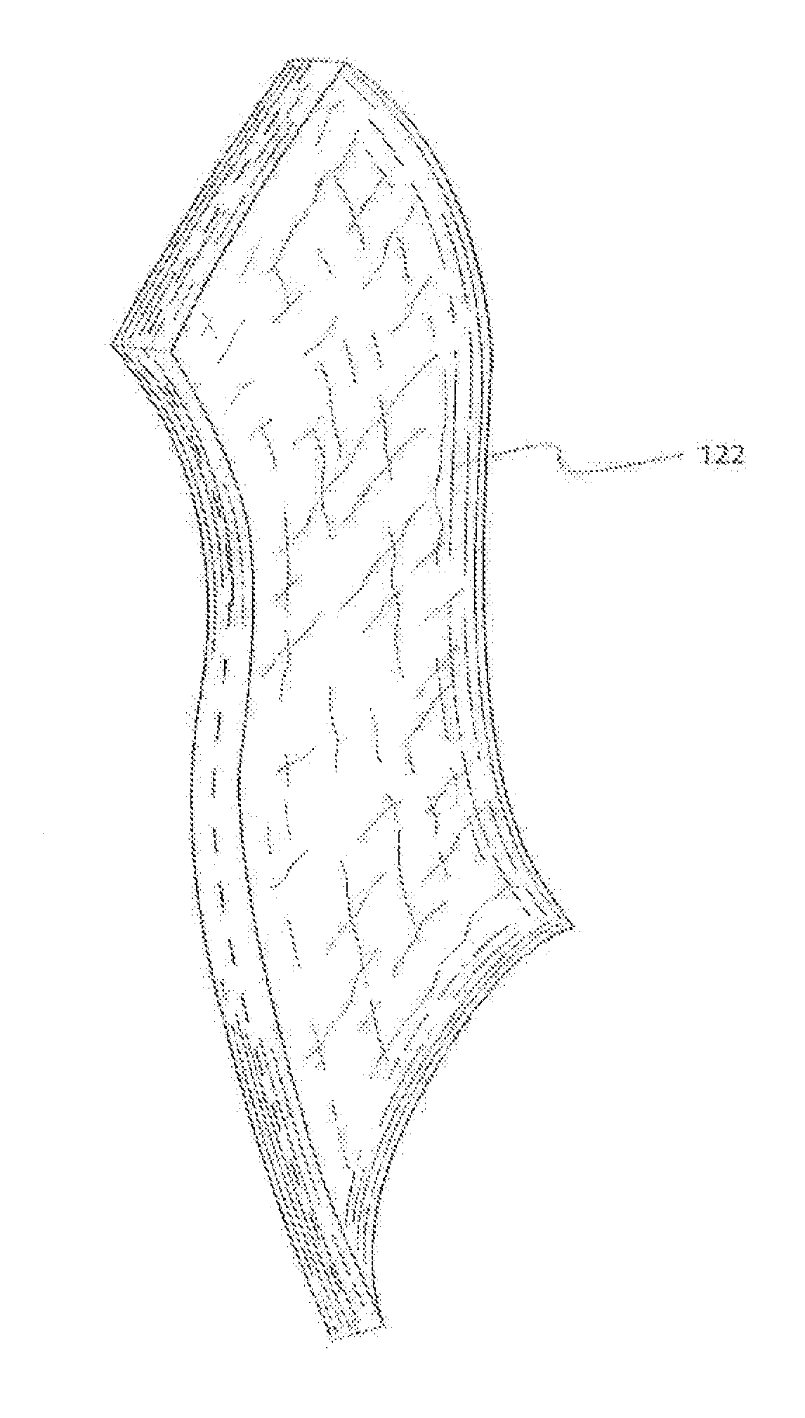 Method and devices for tissue expansion