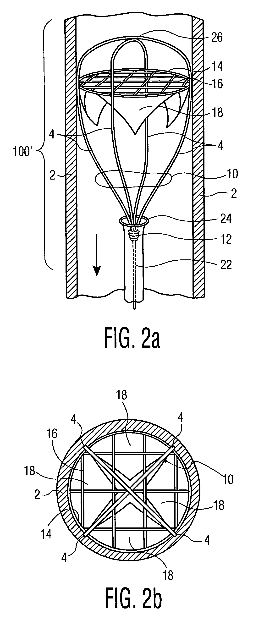 Method of treatment and devices for the treatment of left ventricular failure