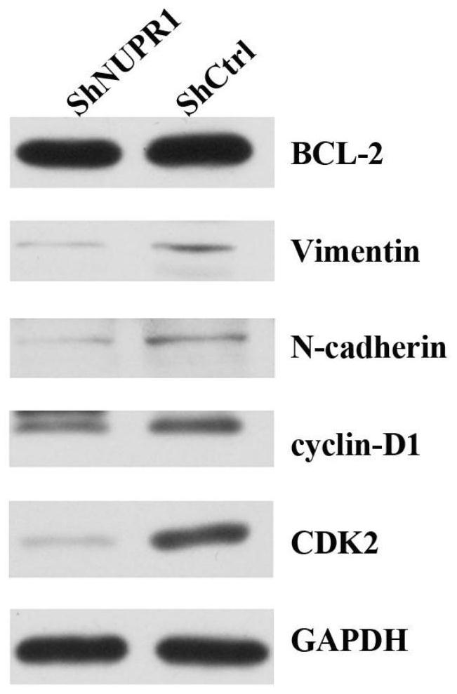 Use of nupr1 inhibitors in the preparation of bladder cancer treatment drugs