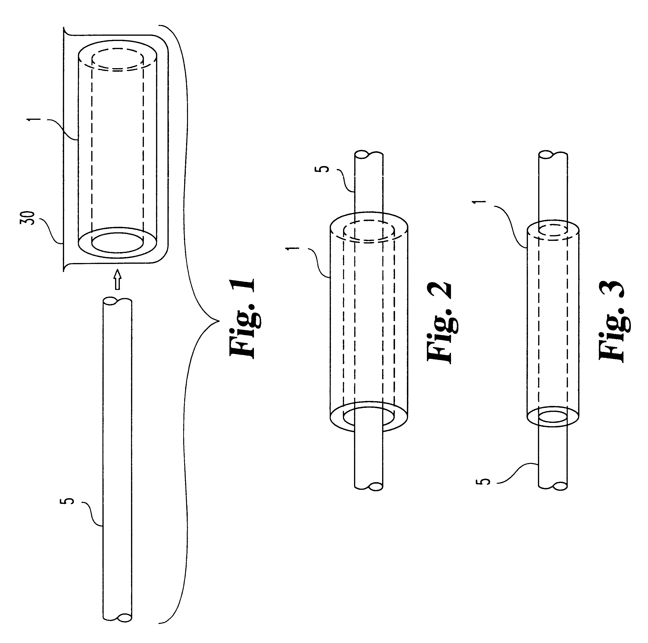 Methods for attaching an elastomeric sleeve to an elongate article
