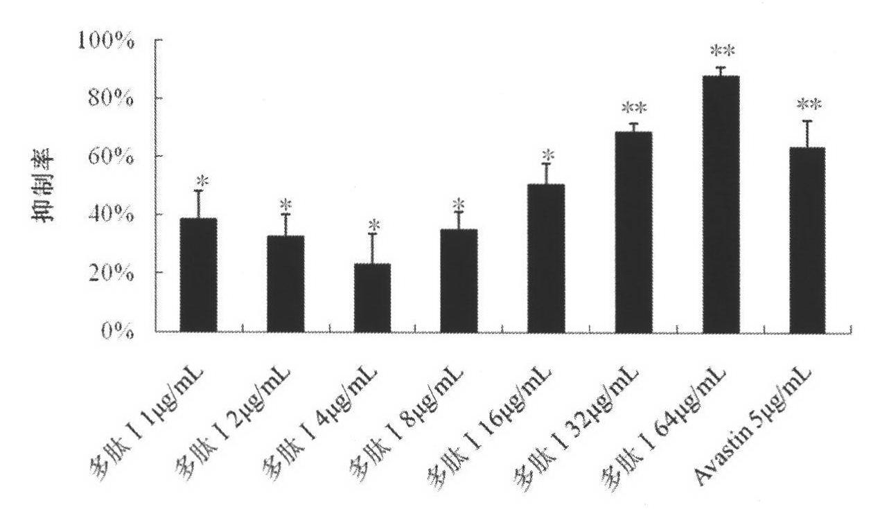 Application of integrin blocker in preparation of medicaments for treating ocular neovascular diseases