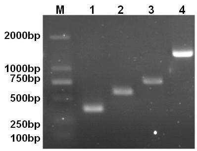 Primer set and kit for detecting avian leukemia virus A/B/J/K subgroup through one-step PCR