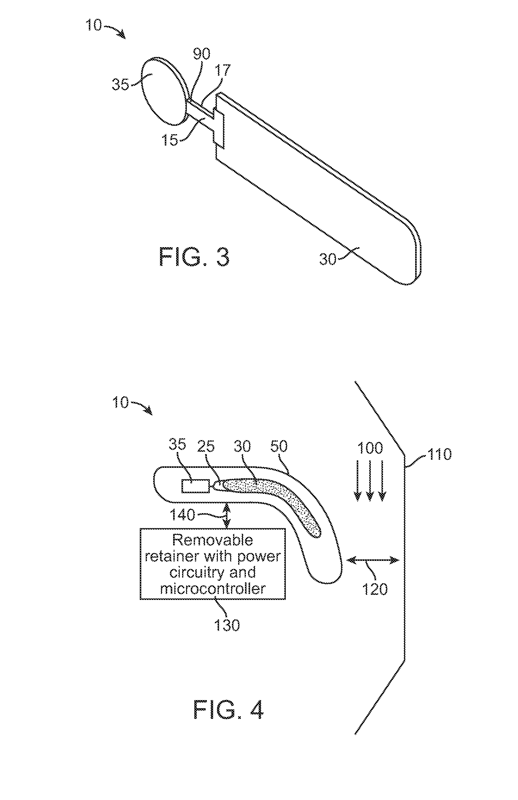 Detection of implant functionality