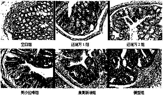 A traditional Chinese medicine composition for preventing or treating canceration of ulcerative colitis and its application